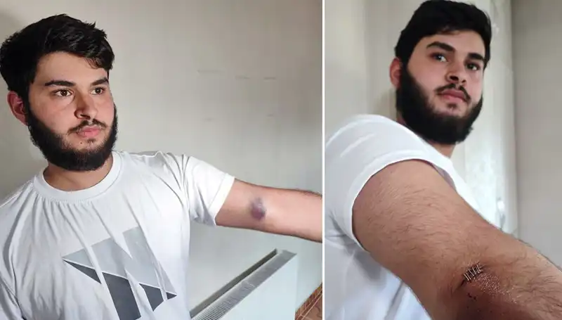 Bahçeye Kaçan Top, Mahallede Gündemi Sarsan Olayı Başlattı
